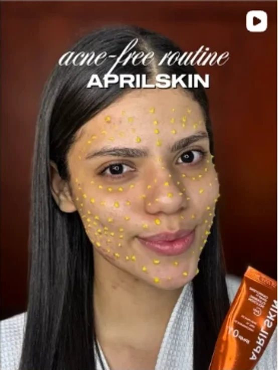 Rutina anti-acné